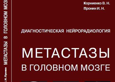 Монография «Метастазы в головном мозге», под авторством Долгушина М.Б.